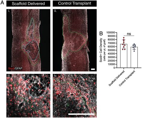 Clickable Granular Hydrogel Scaffolds For Delivery Of Neural Progenitor Cells To Sites Of Spinal