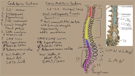 Conus Medullaris Anatomy - Anatomical Charts & Posters