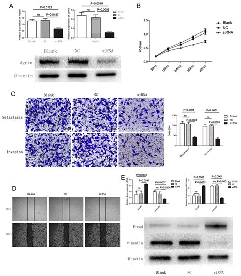 Agrin Knockdown And Its Effect On Cell Proliferation Migration And