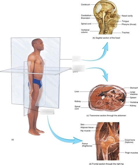 Anatomical Planes Diagram | Quizlet