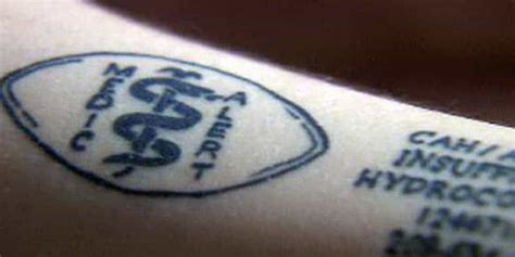 Medical Tattoos: What Exactly Are They Used For?