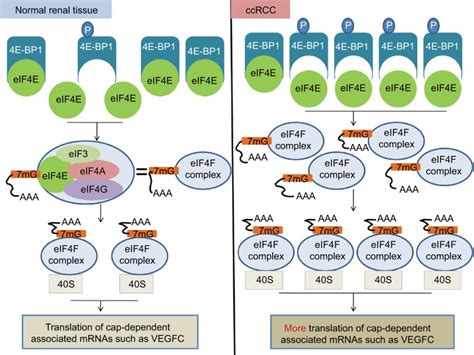 Expression Of 4e Bp1 And Phospho 4e Bp1 Correlates With The Prognosis Of Patients With Clear