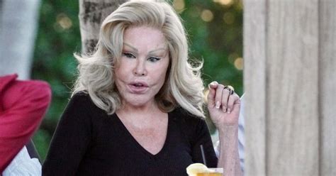 Smutn Foto Kedysi Kr Snej Jocelyn Wildenstein V Mladosti Bola Kr Sna