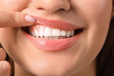 Guest Post Two Of The Best Things You Can Do To Have Healthy Gums Toothbody