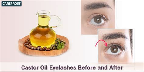 Castor Oil Eyelashes Before And After Unveiling The Secrets Of Natural Growth