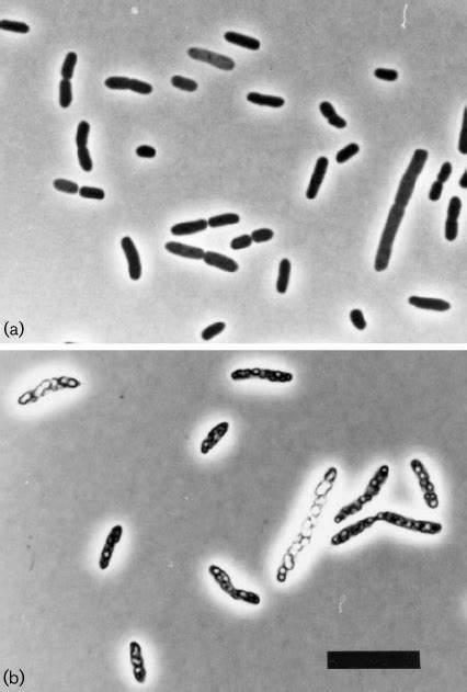 Phase Contrast Micrographs Of Strain P1 T Demonstrating Download