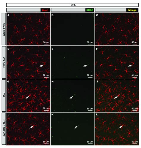 Retinal Wholemount Double Immunostaining With Anti Iba Red And