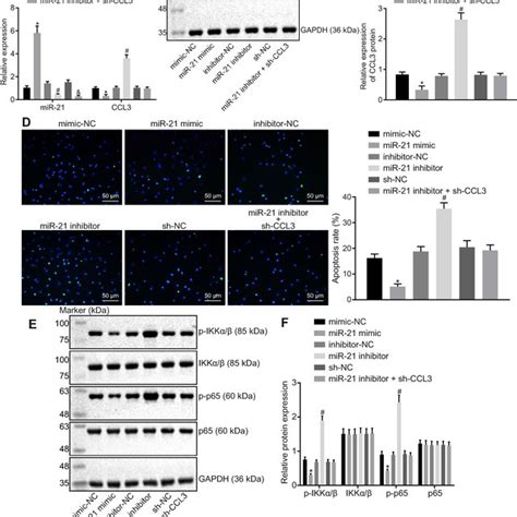 miR 21 protects neurons against OGD induced injury and blocks the NF κB