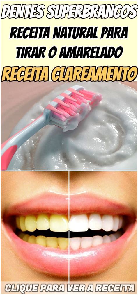 Como Clarear Os Dentes Em Apenas Minuto Passo A Passo Clarear