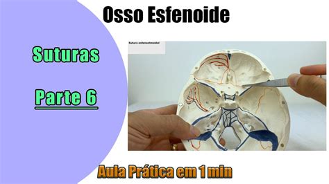 Osso Esfenoide Aula Pr Tica Parte Anatomia Anatomia Humana