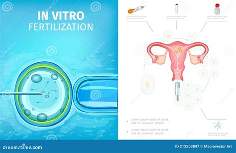 Composição Plana Do Processo De Fertilização In Vitro Ilustração Do