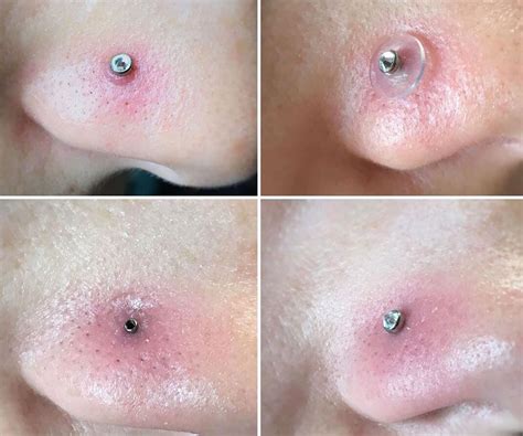 Nose Piercing Infection Treatment Atelier Yuwa Ciao Jp