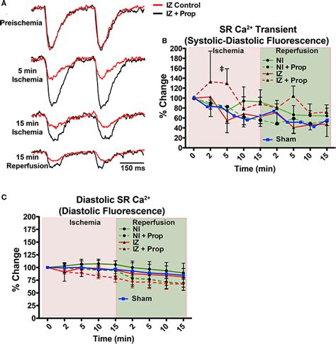 9 Action Potential Diagram Neuron Eyviefarahna