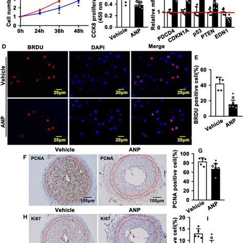 Andrographolide Inhibits Proliferation Of Vascular Smooth Muscle Cells