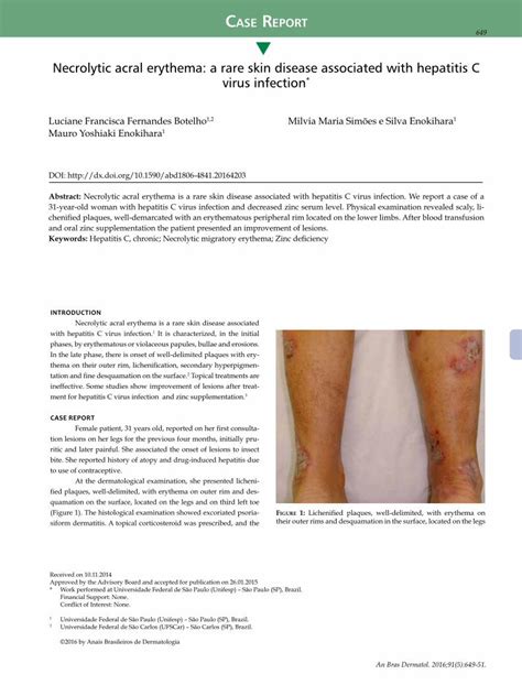 Pdf S Necrolytic Acral Erythema A Rare Skin Disease · Abstract Necrolytic Acral Erythema