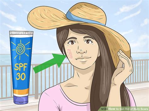 3 Ways to Get Rid of Burn Scars - wikiHow