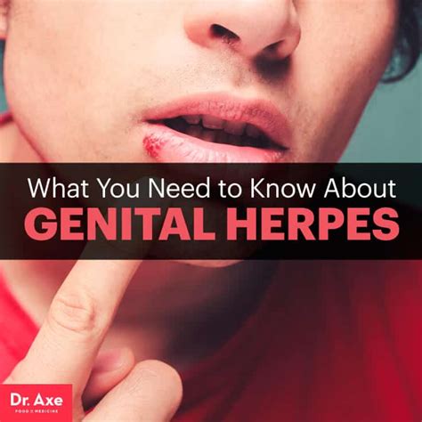 Herpes Symptoms | www.pixshark.com - Images Galleries With A Bite!