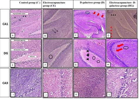 Dentate Gyrus Histology