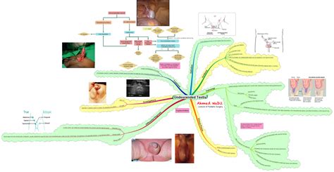 Undescended Testis Chart Pediatric Surgery Club