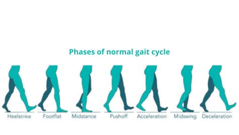 Running Assessment Gait Analysis Service Alliston Physio Clinic