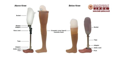 Kategori Produk KNEE — Distributor Kaki Palsu Indonesia — Membuat Dan Menjual Kaki Palsu