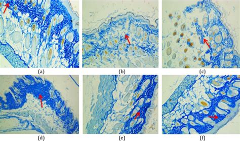 Histological Observation Of Collagens On Mice Dorsal Mus Musculus Download Scientific Diagram