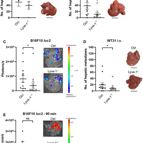 The Loss Of Lyve 1 Protects Against Hepatic Melanoma Metastasis A