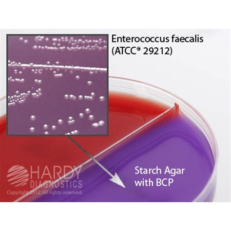 Hardy Diagnostic J181 Dry Culture Media V Agarstarch W Bcp Biplate