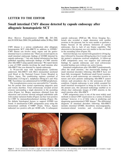 (PDF) Small intestinal CMV disease detected by capsule endoscopy after ...