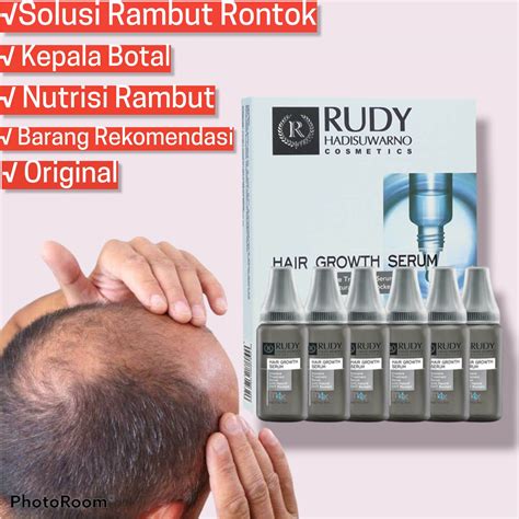 Solusi Rambut Rontok Penumbuh Kepala Botak Serum Rudy Hadisuwarno Hair