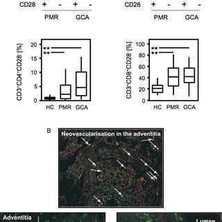 Expression Of Nkg D On Circulating Cd Cd And Cd T Cells From