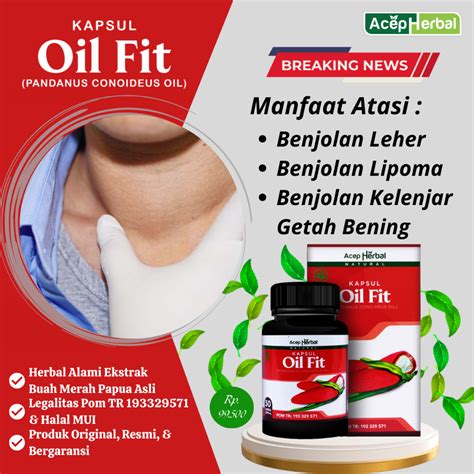 Jual Obat Benjolan Leher Benjolan Lipoma Benjolan Diketiak Benjolan