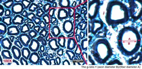 Toluidine Blue Stain Recipe Deporecipe Co