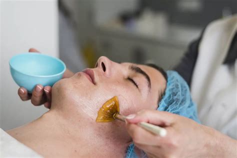 Manfaat Dan Cara Penggunaan Chemical Peeling Untuk Kulit Wajah