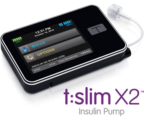 Fda Approves Tandem S T Slim X Pump For Use With Dexcom G Mobile Cgm