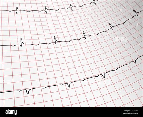 Ekg Stock Photo Alamy