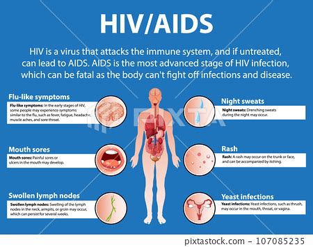 HIV AIDS Virus Effects On Immune System And Body Stock Illustration