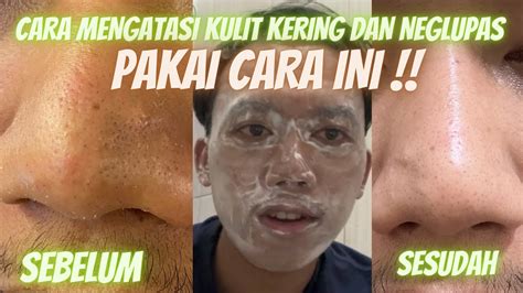 Tutorial Cara Mengatasi Kulit Wajah Kering Dan Mengelupas Pakai Aja Cara Ini Langsung Seger ‼️