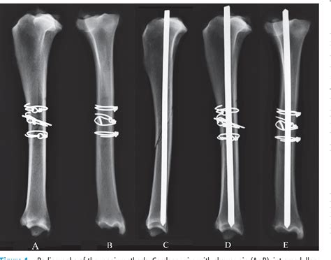 Table 1 From In Vitro Biomechanical Comparison Of The Effects Of