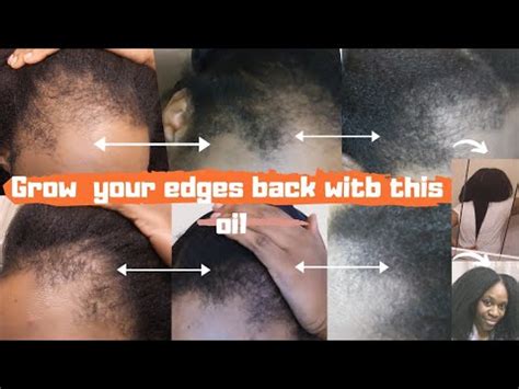 DIYMake This Hair Growth Oil To Regrow Your Hair Edges For Realistic