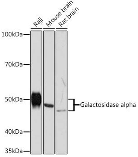 Anti Galactosidase Alpha 抗体 Cab5119 Assay Genie