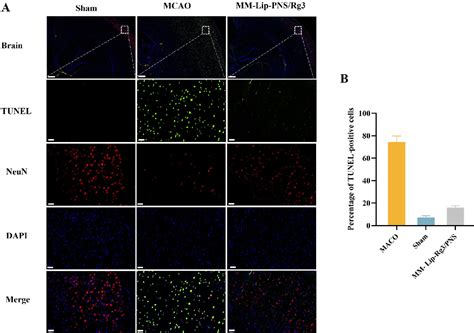 Figure From The Optimization Design Of Macrophage Membrane