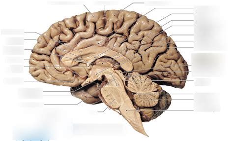 Ch Sectional View Of The Brain Diagram Quizlet