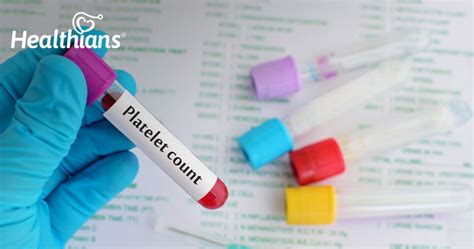 Learn How To Naturally Raise Your Platelet Count Healthians Blog