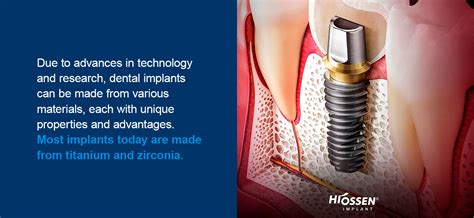 What Are Dental Implants Made Of Hiossen Implant