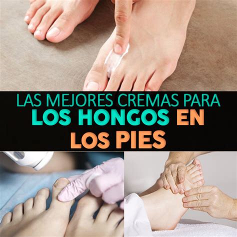 Las Mejores Cremas Para Los Hongos En Los Pies La Guía de las Vitaminas