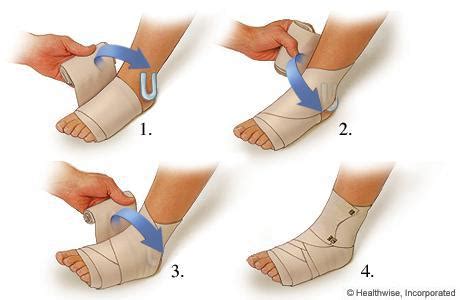 Applying a Compression Wrap for a Sprained Ankle | Absolute Foot and ...