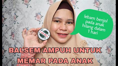 SALEP LUKA MEMAR PALING AMPUH UNTUK ANAK CREAM ZAMBUK REVIEW YouTube