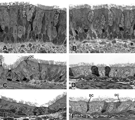 High Resolution Light Micrograph Of Representative Airway Epithelium