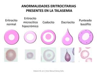 Talasemias Ppt